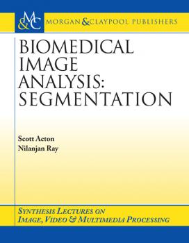 Скачать Biomedical Image Analysis - Nilanjan Ray