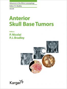 Скачать Anterior Skull Base Tumors - Группа авторов