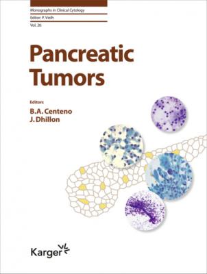 Pancreatic Tumors - Группа авторов Monographs in Clinical Cytology