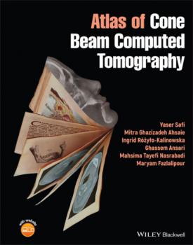 Скачать Atlas of Cone Beam Computed Tomography - Ghassem Ansari