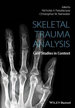 Скачать Skeletal Trauma Analysis. Case Studies in Context - Christopher Rainwater W.